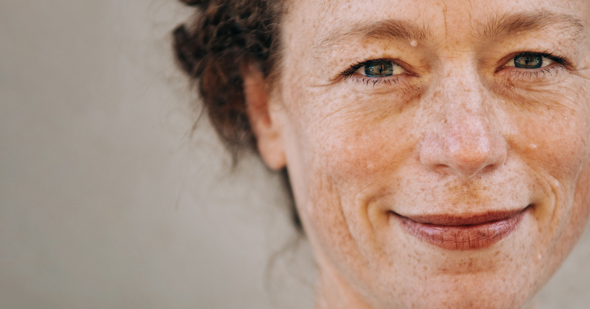 How to get rid of age spots